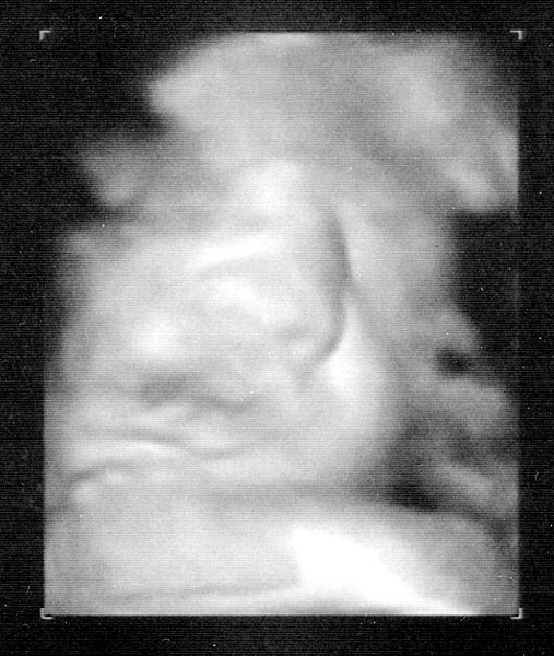 Sonogram01A another one on the way... ©2011 Darin Fong Photography
